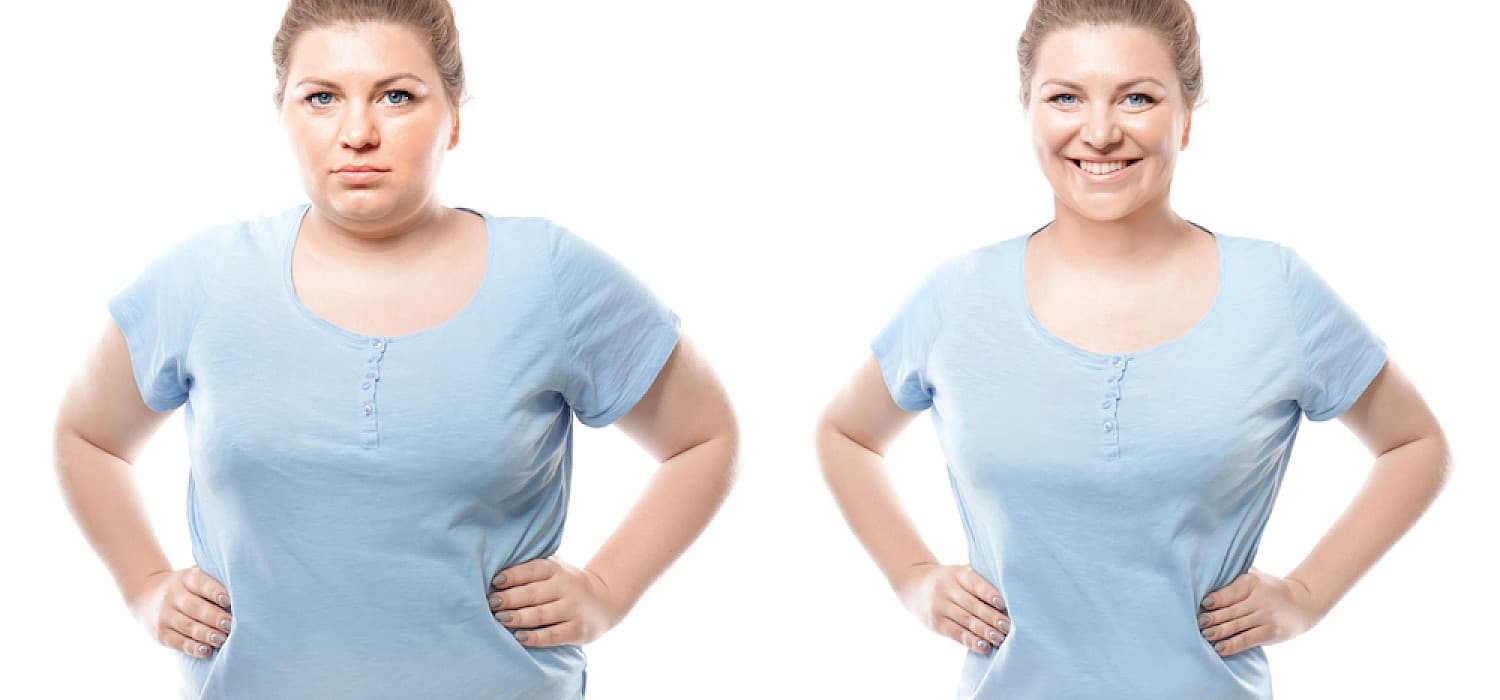 Gastric Sleeve Hypnotherapy Services